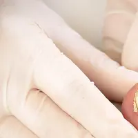 Close-up of a person's foot with a nail infection, suggesting a need for medical attention.