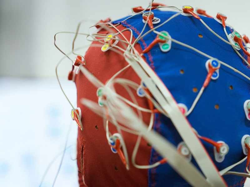 A close-up of a person wearing a skull cap fitted with electrical sensors connected to wires.